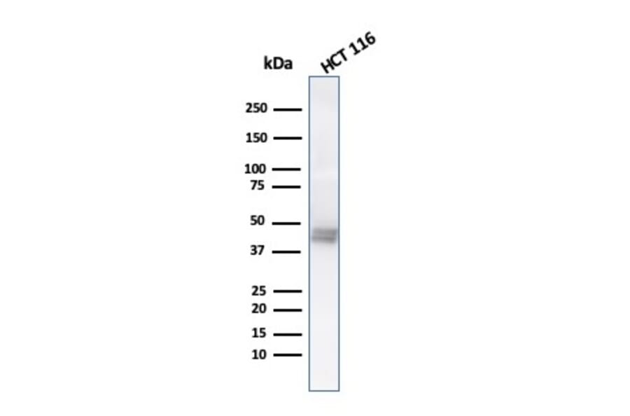 Western Blot - Anti-Cytokeratin 8 Antibody [K8.8] - BSA and Azide free (A252335) - Antibodies.com