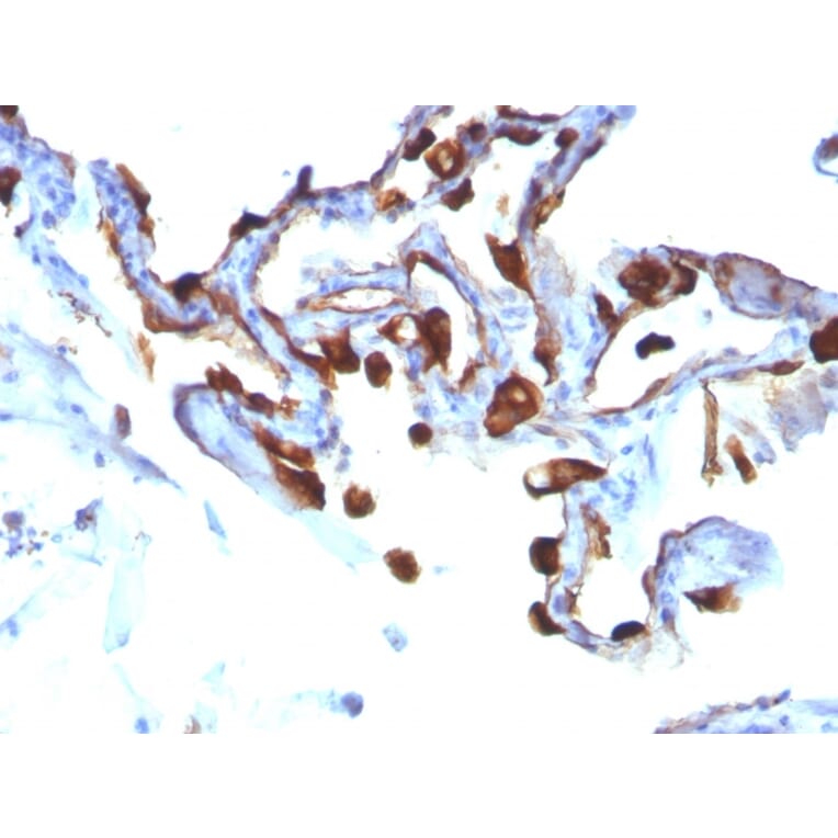 Immunohistochemistry - Anti-Cytokeratin 8 Antibody [KRT8/803] - BSA and Azide free (A252335) - Antibodies.com