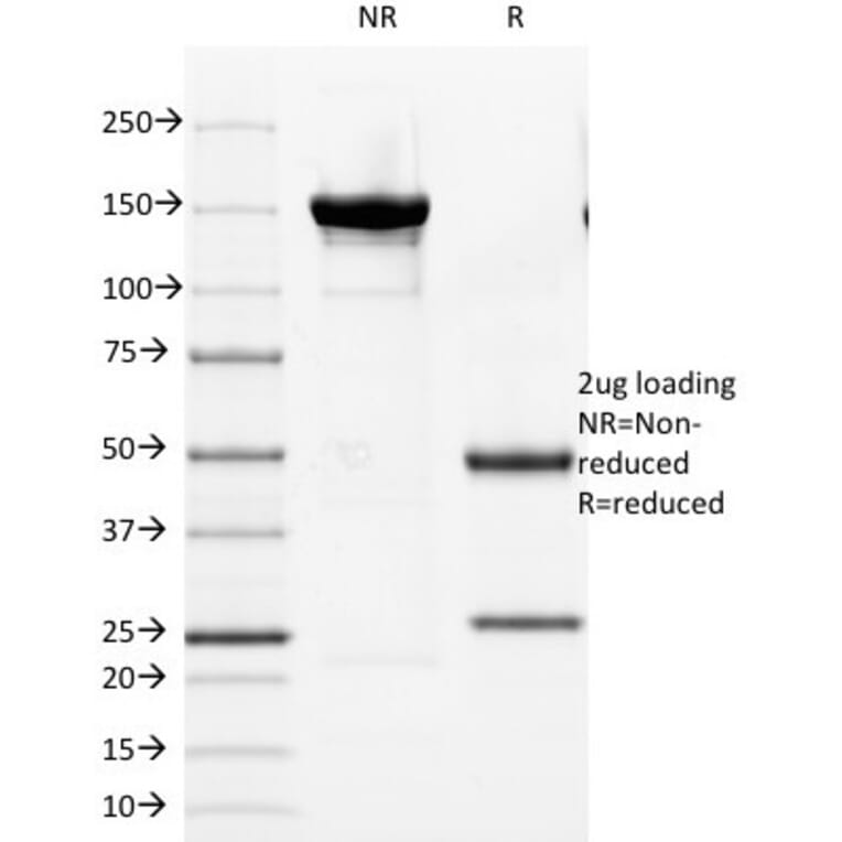 SDS-PAGE - Anti-Cytokeratin 8 Antibody [KRT8/803] - BSA and Azide free (A252336) - Antibodies.com