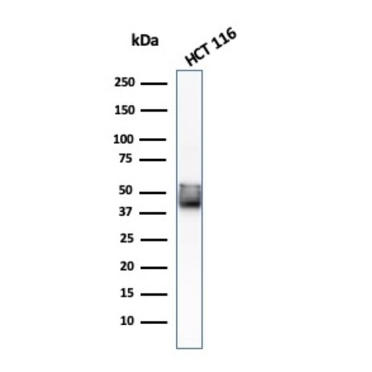 Western Blot - Anti-Cytokeratin 8 Antibody [KRT8/803] - BSA and Azide free (A252336) - Antibodies.com