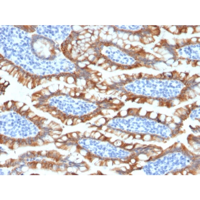 Immunohistochemistry - Anti-Cytokeratin 8 Antibody [KRT8/2174R] - BSA and Azide free (A252336) - Antibodies.com