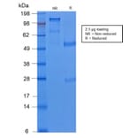 SDS-PAGE - Anti-Cytokeratin 8 Antibody [KRT8/2174R] - BSA and Azide free (A252337) - Antibodies.com