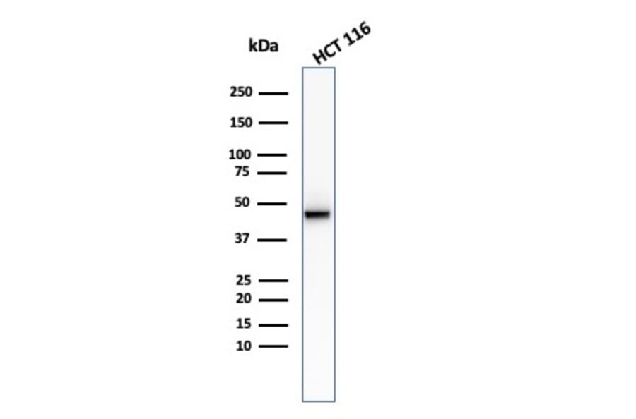 Western Blot - Anti-Cytokeratin 8 Antibody [KRT8/2174R] - BSA and Azide free (A252337) - Antibodies.com