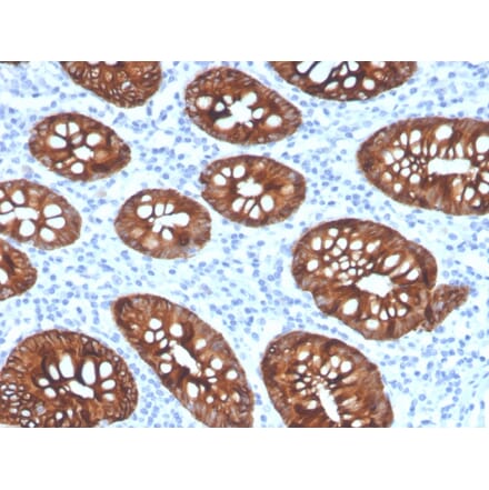 Immunohistochemistry - Anti-Cytokeratin 8 Antibody [KRT8/4067R] - BSA and Azide free (A252338) - Antibodies.com