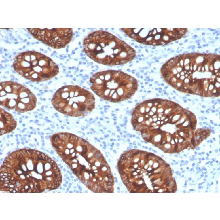 Immunohistochemistry - Anti-Cytokeratin 8 Antibody [KRT8/4067R] - BSA and Azide free (A252338) - Antibodies.com