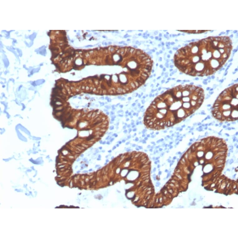 Immunohistochemistry - Anti-Cytokeratin 8 Antibody [KRT8/4067R] - BSA and Azide free (A252337) - Antibodies.com