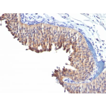 Immunohistochemistry - Anti-Cytokeratin 10 Antibody [LH2] - BSA and Azide free (A252338) - Antibodies.com