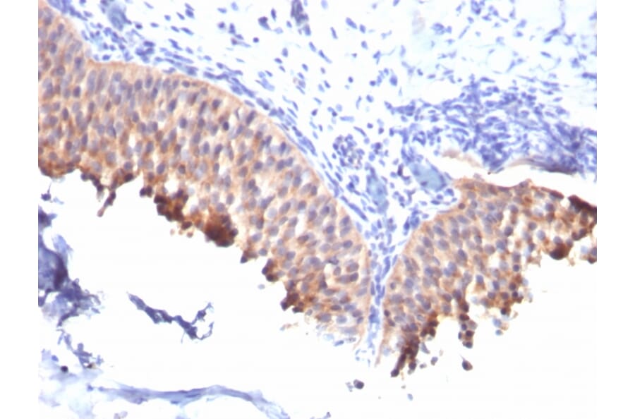 Immunohistochemistry - Anti-Cytokeratin 10 Antibody [SPM261] - BSA and Azide free (A252339) - Antibodies.com