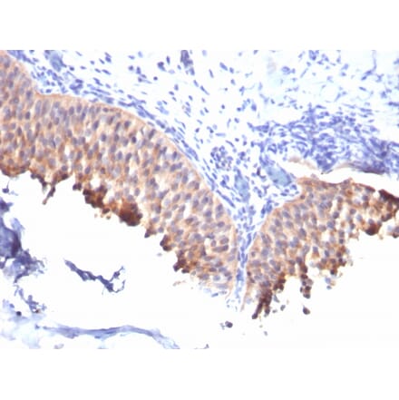 Immunohistochemistry - Anti-Cytokeratin 10 Antibody [SPM261] - BSA and Azide free (A252339) - Antibodies.com