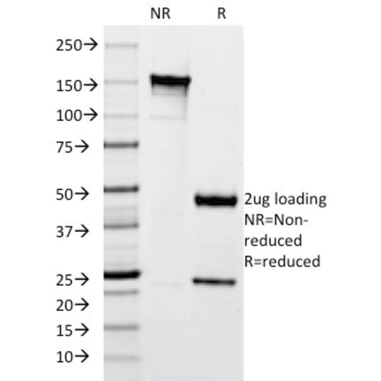 SDS-PAGE - Anti-Cytokeratin 10 Antibody [SPM261] - BSA and Azide free (A252340) - Antibodies.com
