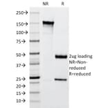 SDS-PAGE - Anti-Cytokeratin 10 Antibody [SPM261] - BSA and Azide free (A252340) - Antibodies.com