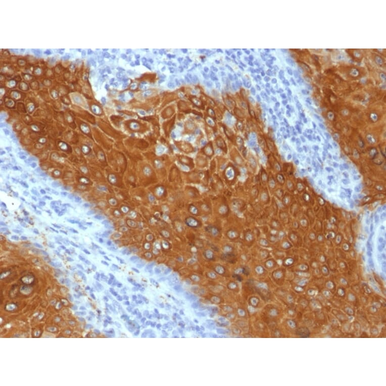 Immunohistochemistry - Anti-Cytokeratin 10 Antibody [KRT10/844] - BSA and Azide free (A252340) - Antibodies.com