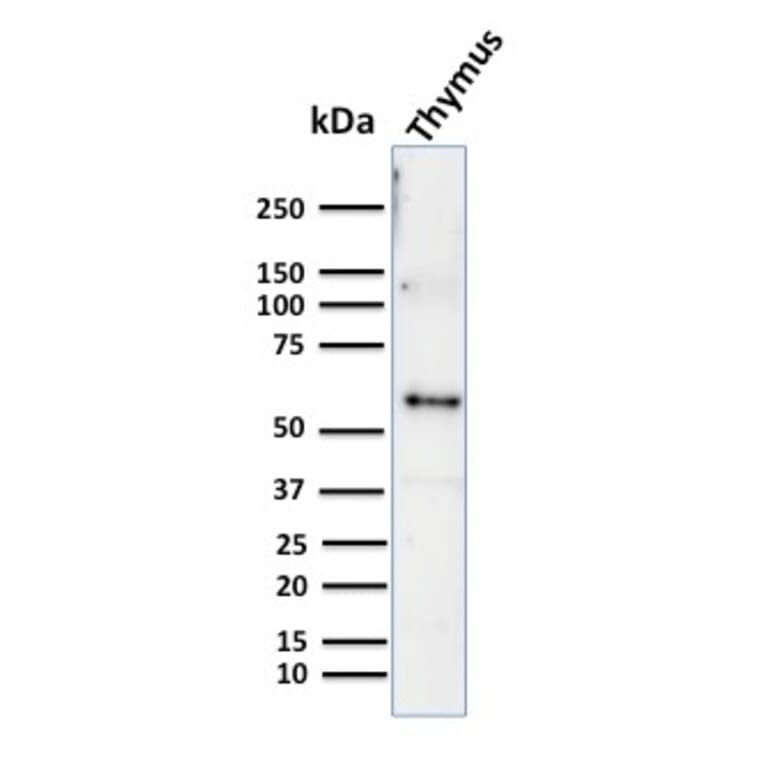 Western Blot - Anti-Cytokeratin 10 Antibody [KRT10/844] - BSA and Azide free (A252341) - Antibodies.com