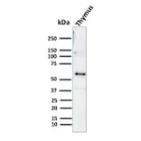 Western Blot - Anti-Cytokeratin 10 Antibody [KRT10/844] - BSA and Azide free (A252341) - Antibodies.com