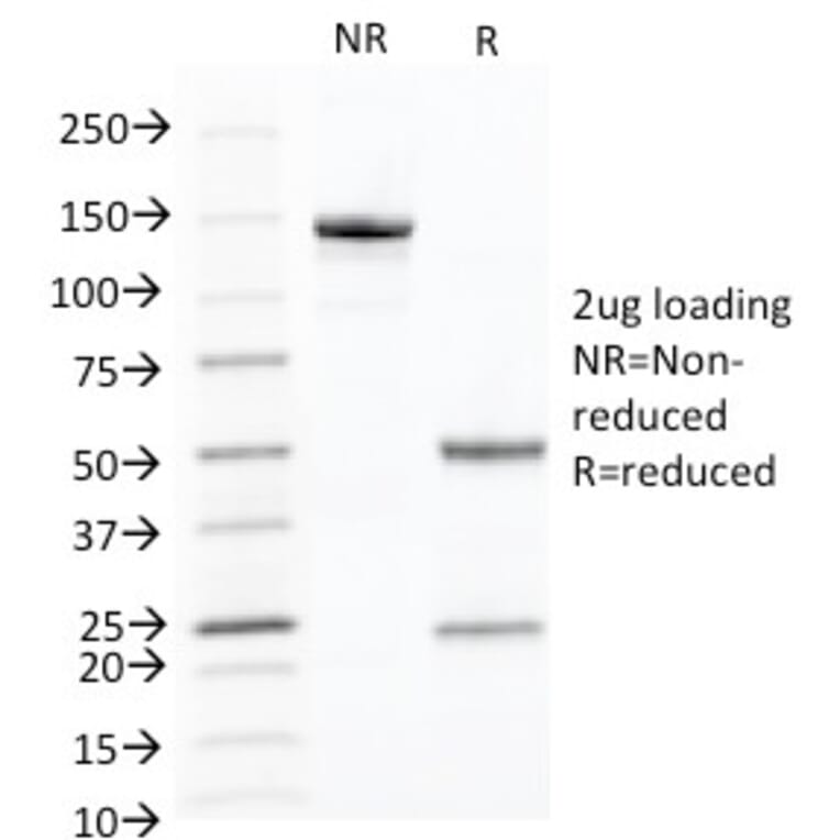 SDS-PAGE - Anti-Cytokeratin 10 Antibody [KRT10/844] - BSA and Azide free (A252341) - Antibodies.com