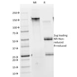 SDS-PAGE - Anti-Cytokeratin 10 Antibody [DE-K10] - BSA and Azide free (A252342) - Antibodies.com