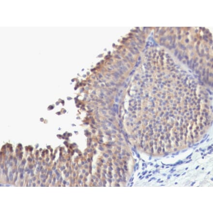 Immunohistochemistry - Anti-Cytokeratin 10 Antibody [SPM623] - BSA and Azide free (A252342) - Antibodies.com