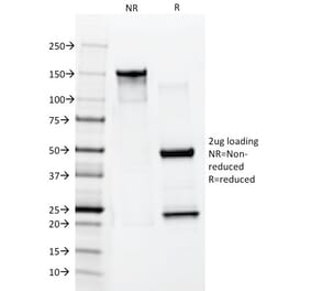 SDS-PAGE - Anti-Cytokeratin 10 Antibody [AE20] - BSA and Azide free (A252344) - Antibodies.com