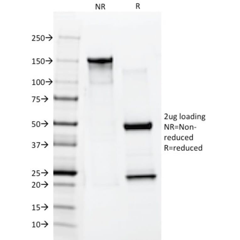 SDS-PAGE - Anti-Cytokeratin 10 Antibody [AE20] - BSA and Azide free (A252344) - Antibodies.com