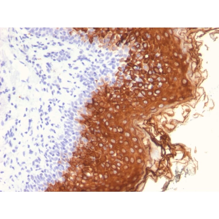 Immunohistochemistry - Anti-Cytokeratin 10 Antibody [AE20] - BSA and Azide free (A252343) - Antibodies.com