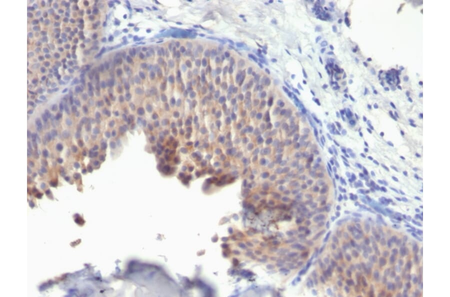 Immunohistochemistry - Anti-Cytokeratin 10 Antibody [KRT10/1275] - BSA and Azide free (A252344) - Antibodies.com