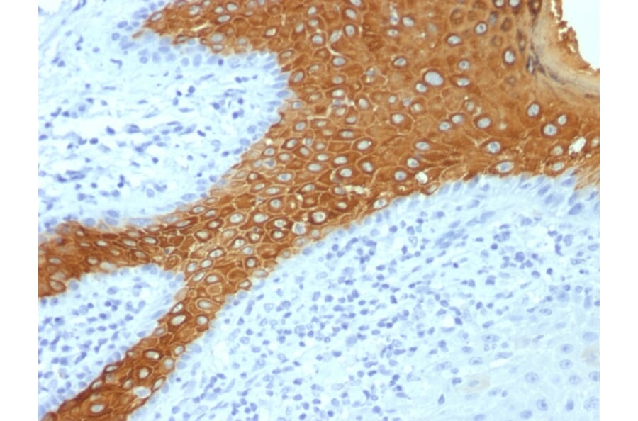 Immunohistochemistry - Anti-Cytokeratin 10 Antibody [KRT10/844 + KRT10/1275] - BSA and Azide free (A252345) - Antibodies.com