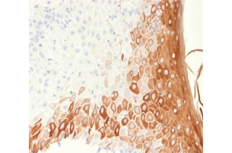 Immunohistochemistry - Anti-Cytokeratin 10 Antibody [rKRT10/1275] - BSA and Azide free (A252346) - Antibodies.com