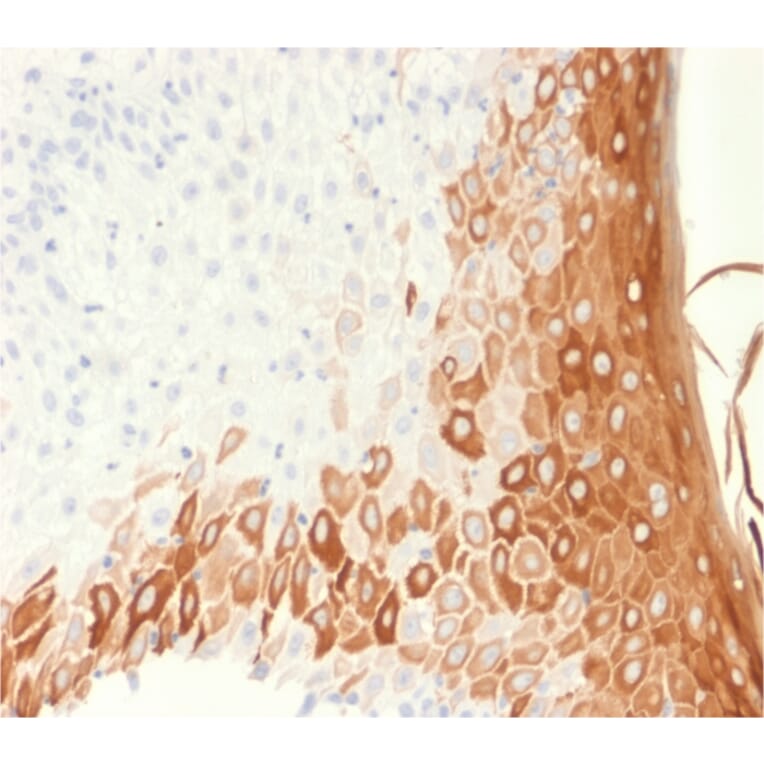 Immunohistochemistry - Anti-Cytokeratin 10 Antibody [rKRT10/1275] - BSA and Azide free (A252346) - Antibodies.com