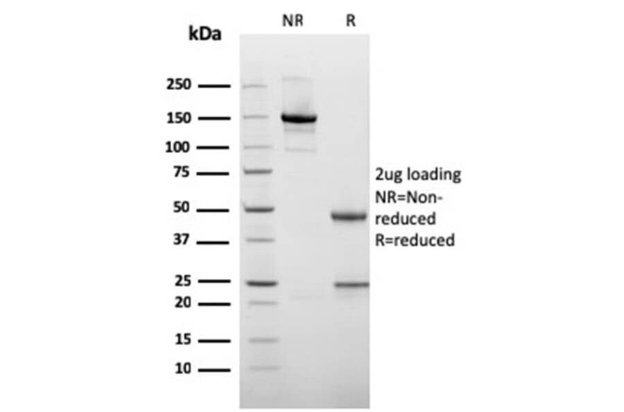 SDS-PAGE - Anti-Cytokeratin 10 Antibody [rKRT10/1275] - BSA and Azide free (A252347) - Antibodies.com