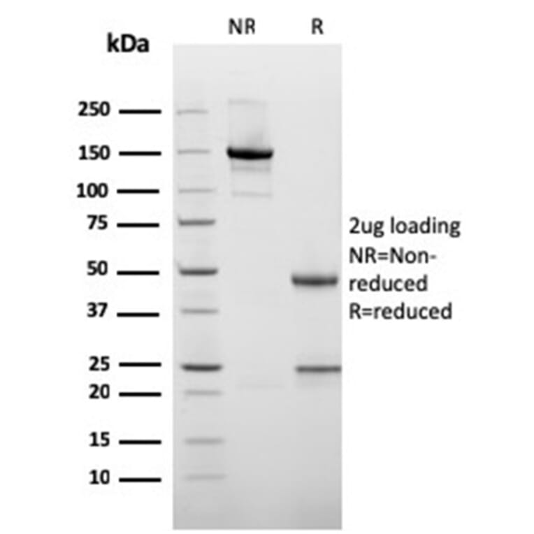 SDS-PAGE - Anti-Cytokeratin 10 Antibody [rKRT10/1275] - BSA and Azide free (A252347) - Antibodies.com