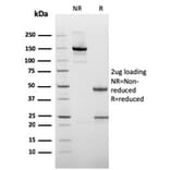 SDS-PAGE - Anti-Cytokeratin 10 Antibody [rKRT10/1275] - BSA and Azide free (A252347) - Antibodies.com