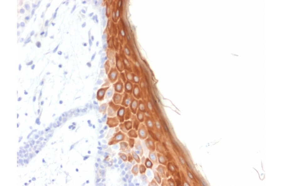 Immunohistochemistry - Anti-Cytokeratin 10 Antibody [rKRT10/844] - BSA and Azide free (A252347) - Antibodies.com