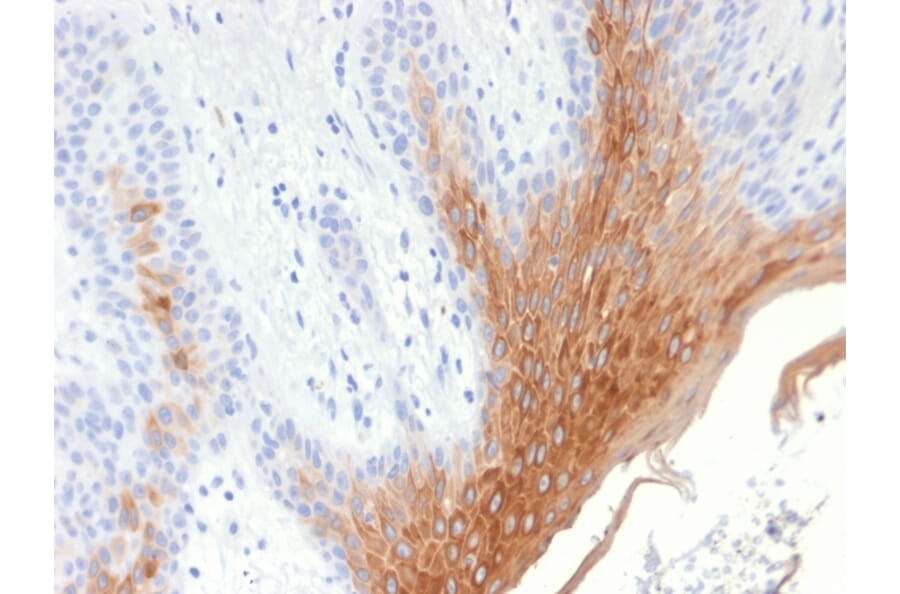 Immunohistochemistry - Anti-Cytokeratin 10 Antibody [KRT10/1990R] - BSA and Azide free (A252348) - Antibodies.com