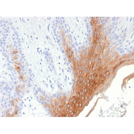 Immunohistochemistry - Anti-Cytokeratin 10 Antibody [KRT10/1990R] - BSA and Azide free (A252348) - Antibodies.com