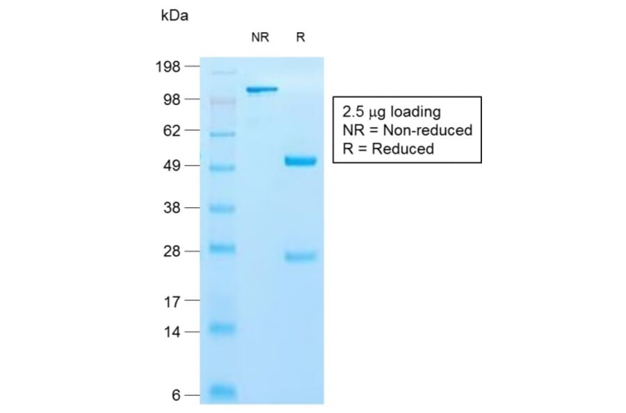 SDS-PAGE - Anti-Cytokeratin 10 Antibody [KRT10/1990R] - BSA and Azide free (A252349) - Antibodies.com