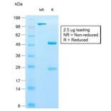 SDS-PAGE - Anti-Cytokeratin 10 Antibody [KRT10/1990R] - BSA and Azide free (A252349) - Antibodies.com