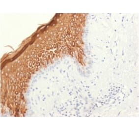 Immunohistochemistry - Anti-Cytokeratin 10 Antibody [KRT10/1948R] - BSA and Azide free (A252349) - Antibodies.com