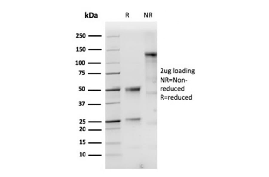 SDS-PAGE - Anti-Cytokeratin 10 Antibody [KRT10/1948R] - BSA and Azide free (A252350) - Antibodies.com