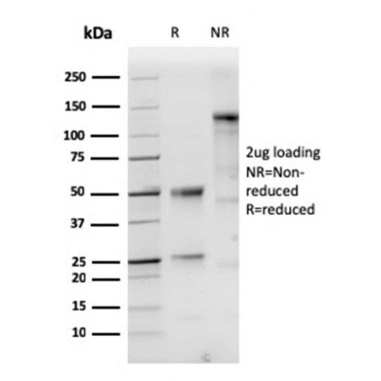 SDS-PAGE - Anti-Cytokeratin 10 Antibody [KRT10/1948R] - BSA and Azide free (A252350) - Antibodies.com