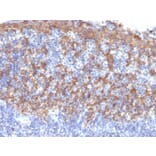Immunohistochemistry - Anti-Cytokeratin 14 Antibody [LL002] - BSA and Azide free (A252353) - Antibodies.com