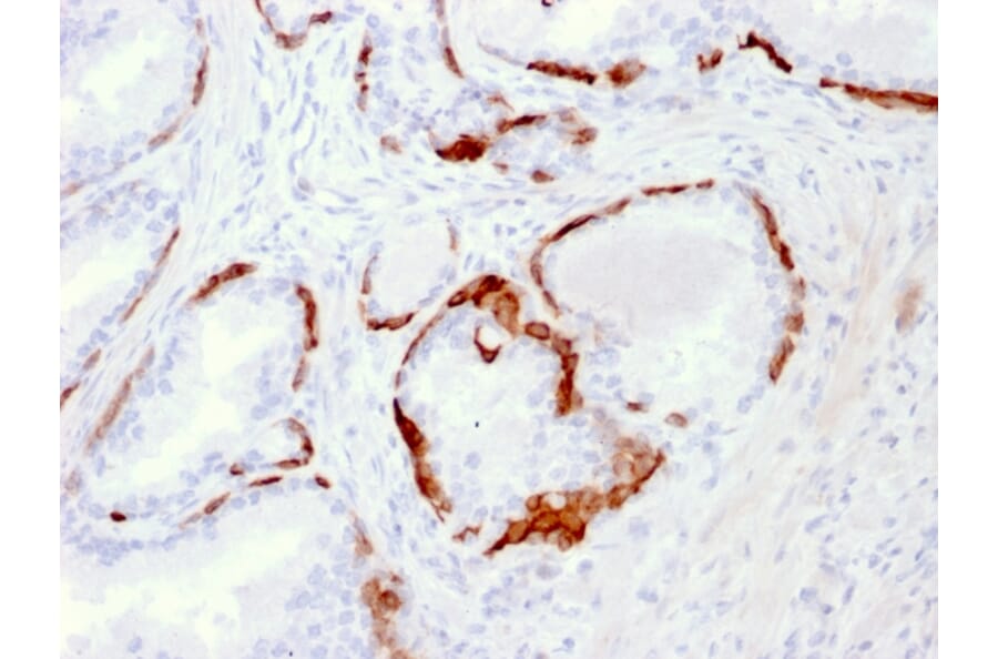 Immunohistochemistry - Anti-Cytokeratin 14 Antibody [LL002] - BSA and Azide free (A252353) - Antibodies.com