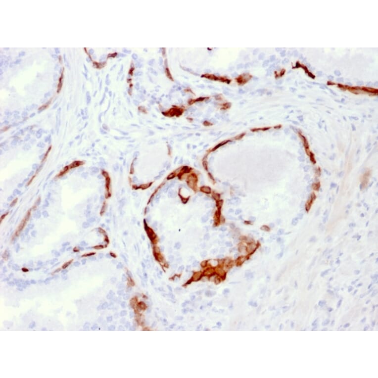 Immunohistochemistry - Anti-Cytokeratin 14 Antibody [LL002] - BSA and Azide free (A252353) - Antibodies.com