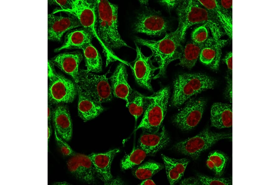 Immunofluorescence - Anti-Cytokeratin 14 Antibody [LL002] - BSA and Azide free (A252353) - Antibodies.com