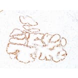 Immunohistochemistry - Anti-Cytokeratin 14 Antibody [SPM263] - BSA and Azide free (A252354) - Antibodies.com