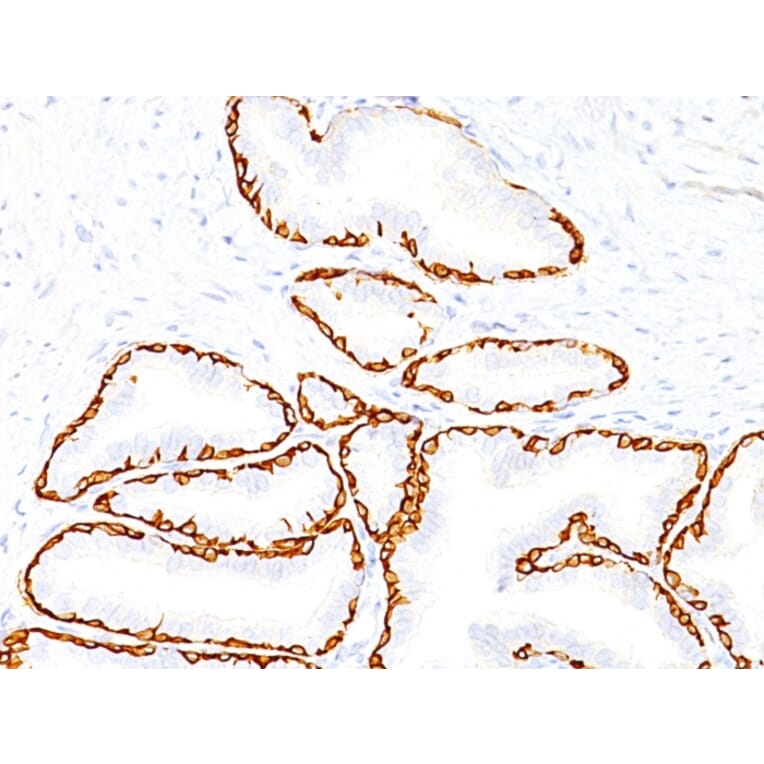 Immunohistochemistry - Anti-Cytokeratin 14 Antibody [SPM263] - BSA and Azide free (A252354) - Antibodies.com