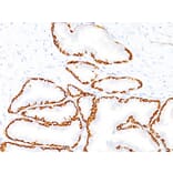 Immunohistochemistry - Anti-Cytokeratin 14 Antibody [SPM263] - BSA and Azide free (A252354) - Antibodies.com