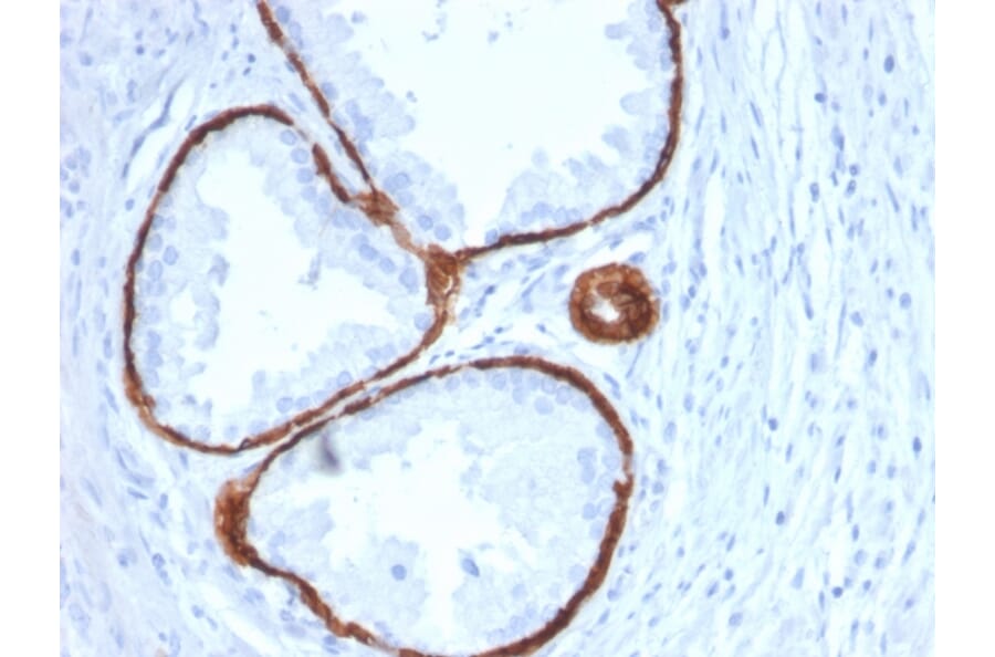 Immunohistochemistry - Anti-Cytokeratin 14 Antibody [KRT14/2375] - BSA and Azide free (A252355) - Antibodies.com