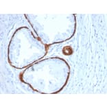 Immunohistochemistry - Anti-Cytokeratin 14 Antibody [KRT14/2375] - BSA and Azide free (A252355) - Antibodies.com