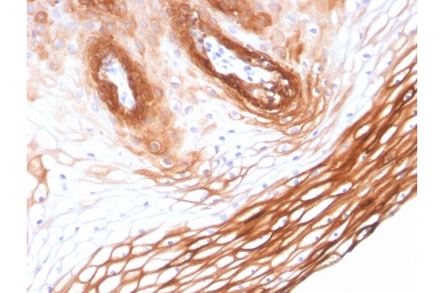 Immunohistochemistry - Anti-Cytokeratin 14 Antibody [KRT14/2375] - BSA and Azide free (A252355) - Antibodies.com
