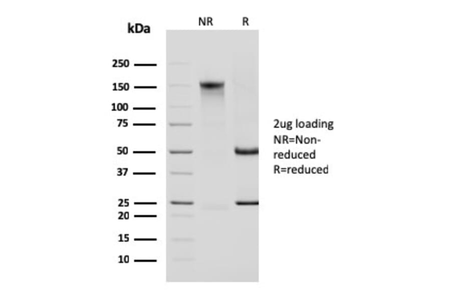 SDS-PAGE - Anti-Cytokeratin 14 Antibody [KRT14/2375] - BSA and Azide free (A252355) - Antibodies.com